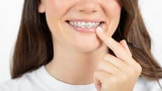 How to Keep Clear Braces Bands From Turning Yellow