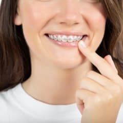 How to Keep Braces Bands From Turning Yellow - And a Great Way to Avoid the Fuss Altogether