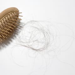 Top 10 Reasons to Consider Hair Loss Treatment Today