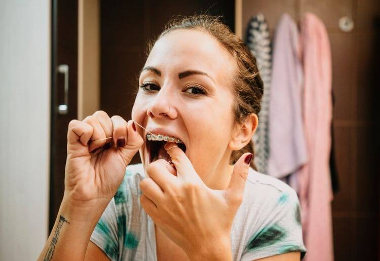 How to Floss With Braces And Why You Really Need To