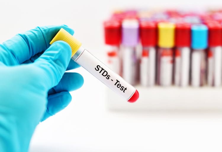 Find Peace of Mind with this 10-Point STD Test